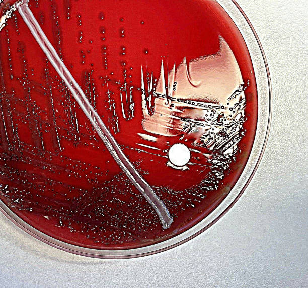 肺炎レンサ球菌 - blood agar ストックフォトと画像