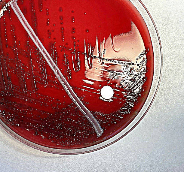 streptococcus pneumoniae z bliska - bacterium microbiology petri dish biological culture zdjęcia i obrazy z banku zdjęć