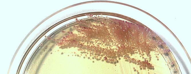 Mixed infection of Candida kefyr and Candida spp. grown on chomogenic agar plate.