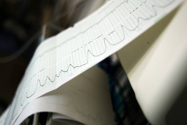 istock Fetal monitor 1198993052