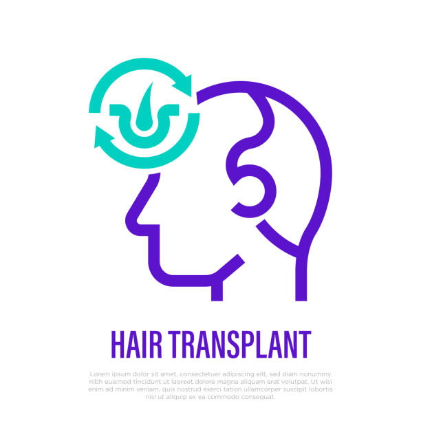 Hair transplantation thin line icon. Hair follicles in arrows. Medical procedure of extraction follicles. Vector illustration. vector art illustration