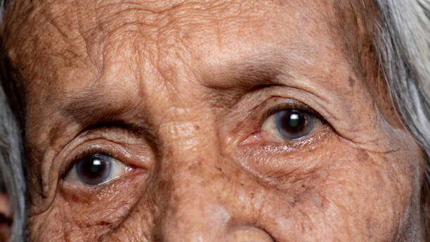 istock The old woman's felling lonely.(dementia and Alzheimer’s disease) 1199160328