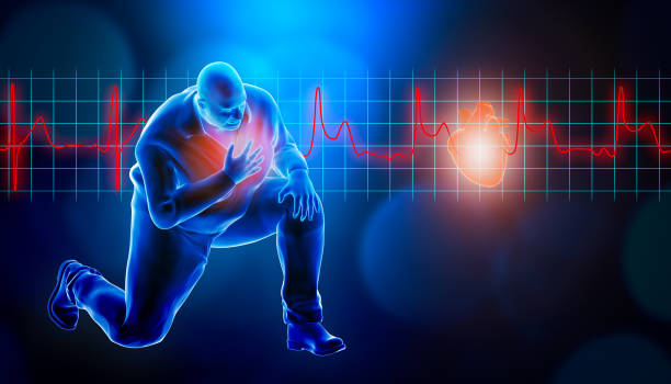 istock Obese of fat man kneeling while suffering from a heart attack 3d rendering illustration. STEMI heart rate EKG in the background and copy space. Medical and healthcare, myocardial infarction concept. 1199198222