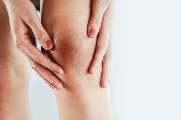 woman having problem with dark and wrinkle skin on knee stock photo