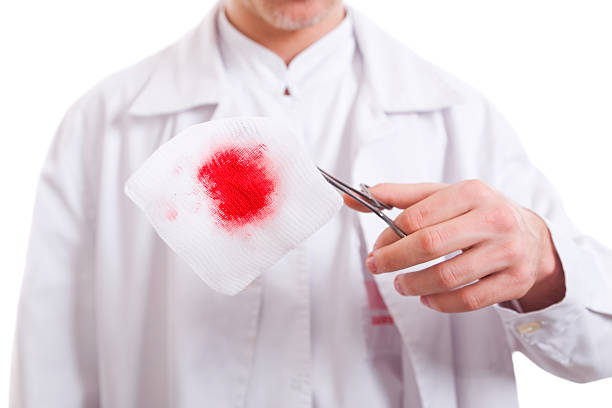 Médico con sangrientos gasa de almohadilla - foto de stock