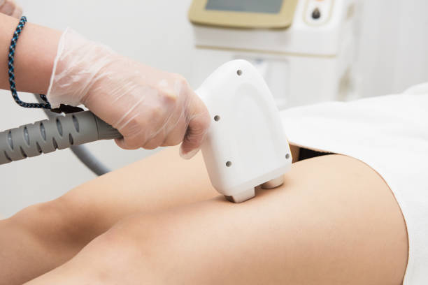 istock Laser epilation of legs 1199452568