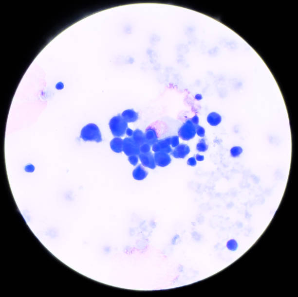 istock Group of Abnormal cell in plural fluid find with microscope. 1199587767
