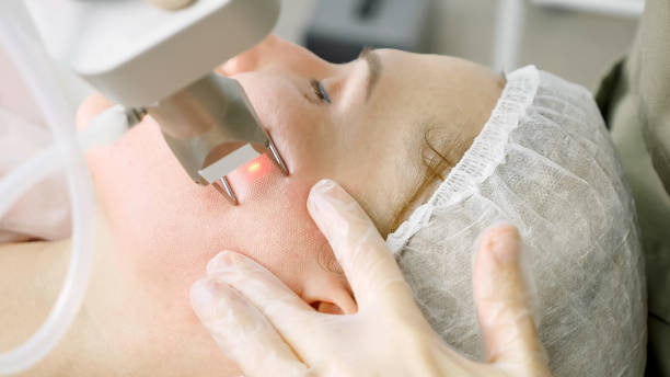 istock therapist makes laser hair removal procedure on patient face 1199596814