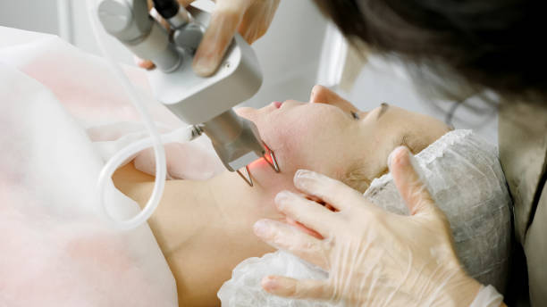 istock therapist makes laser hair removal procedure on patient face 1199596818