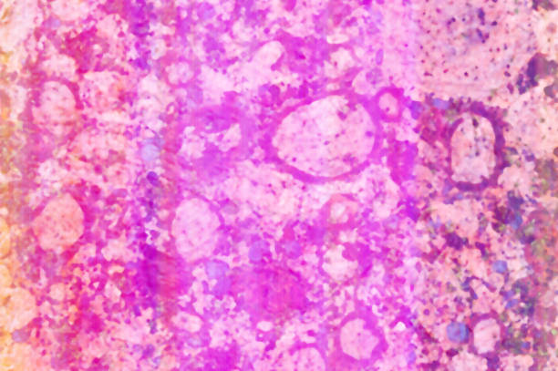 istock pink spots and circles texture, background abstraction circles 1199609136