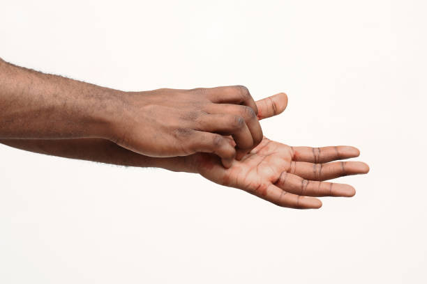 istock Black man scratching itch on his hand 1199666192