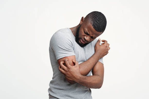 Young black man scratching his itching hand Insect bite allergy. Young afro man scratching his itching hand, white background, copy space men with psoriasis 