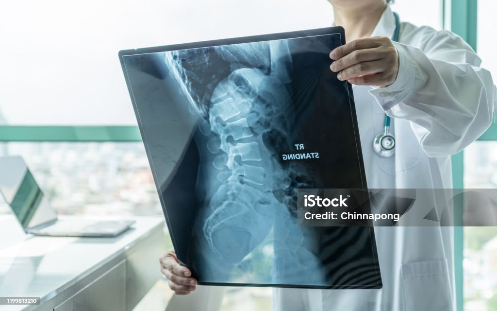 Surgical doctor looking at radiological spinal x-ray film for medical diagnosis on patient health on spine disease, bone cancer illness, spinal muscular atrophy, medical healthcare concept Spine - Body Part Stock Photo