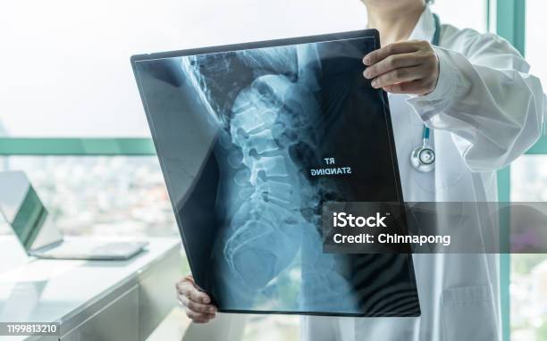 Surgical Doctor Looking At Radiological Spinal Xray Film For Medical Diagnosis On Patient Health On Spine Disease Bone Cancer Illness Spinal Muscular Atrophy Medical Healthcare Concept Stock Photo - Download Image Now