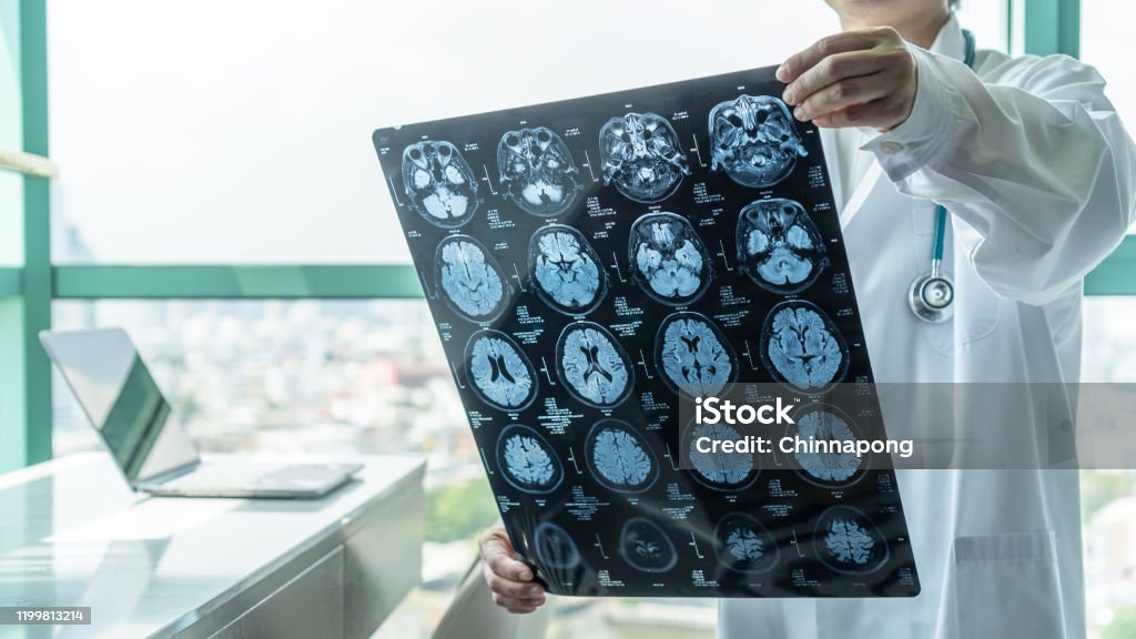 Brain disease diagnosis with medical doctor seeing Magnetic Resonance Imaging (MRI) film diagnosing elderly ageing patient neurodegenerative illness problem for neurological medical treatment Stroke - Illness Stock Photo