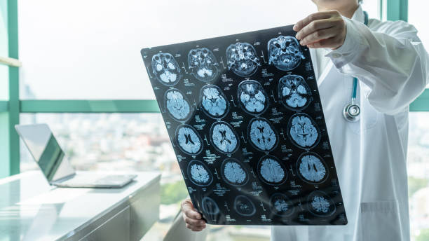 hjärnsjukdom diagnos med läkare se magnetisk resonanstomografi (mri) film diagnostisera äldre åldrande patienter neurodegenerativa sjukdomar problem för neurologisk medicinsk behandling - demens bildbanksfoton och bilder
