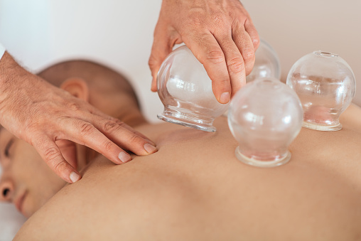 Acupuncturist performs massage cupping therapy on man