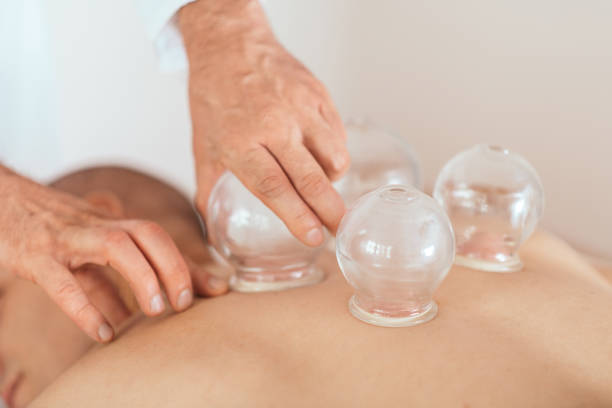 massagem cupping terapia - massaging relaxation indoors traditional culture - fotografias e filmes do acervo