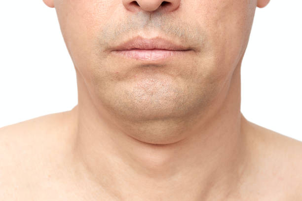 double fat chin Man a double fat chin, a problem with a hanging chin with white background drooping photos stock pictures, royalty-free photos & images
