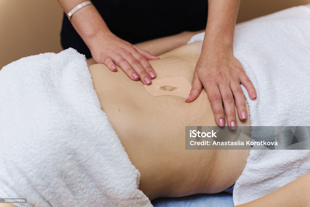 Aftale ambition ubrugt The Patch For Weight Loss Is Glued To The Stomach Of An Adult Woman Massage  For Slimming Anticellulite Stock Photo - Download Image Now - iStock