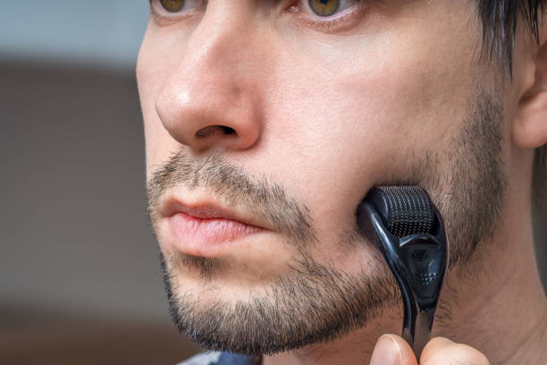 istock Facial hair care concept. Young man is using derma roller  on beard. 1200726706