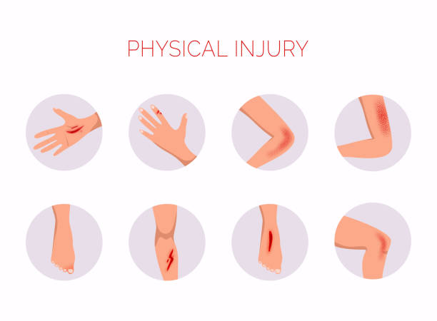 ilustrações de stock, clip art, desenhos animados e ícones de human body physical injury round flat set. open cut wounds and elbow bruise. - elbow