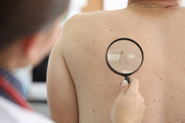 istock Medical worker checking birthmark 1200829560