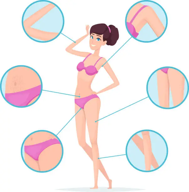 Vector illustration of Woman depilation. Female body hair removal armpits and waxing vector cartoon infographics