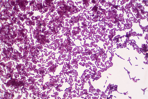 Mancha grampositiva de Bacillus bajo la vista del microscopio. Bacillus es una bacteria en forma de varilla. photo