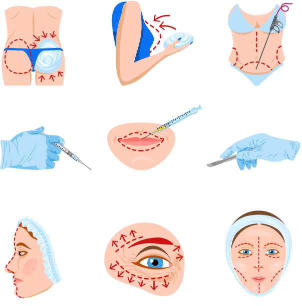 plastic surgery icons Cosmetic facial and body lift plastic surgery flat icon collection with lips contouring abstract isolated vector illustration silicone implants stock illustrations