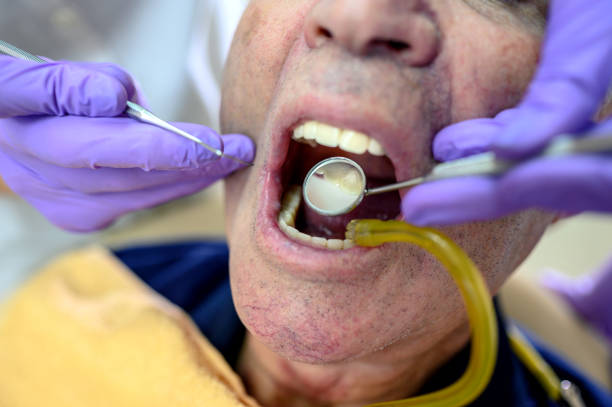 istock Senior man at the dentist 1201148888