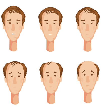 Hair Loss Storyboard Man Stock Illustration - Download Image Now -  1970-1979, Abstract, Adult - iStock