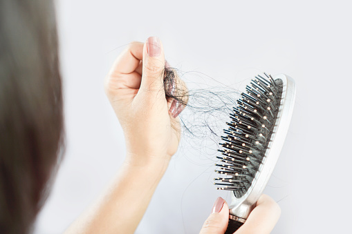 Mujer asiática mano sosteniendo la pérdida de cabello cayendo en el peine photo