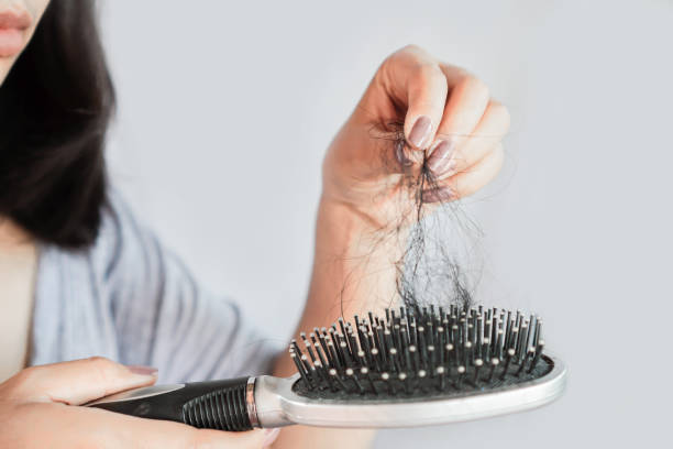 istock Asian woman hand holding hair loss falling on comb 1201166312
