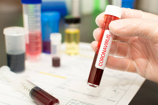 primer plano de coronavirus, sangre en un tubo de análisis - up yours fotografías e imágenes de stock