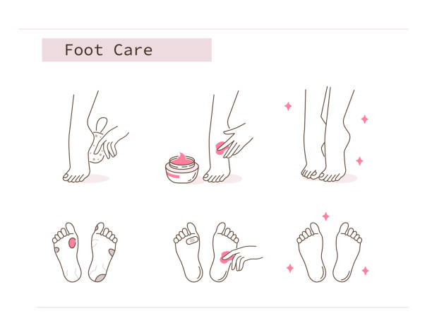 ilustrações, clipart, desenhos animados e ícones de cuidados com os pés - exfoliation