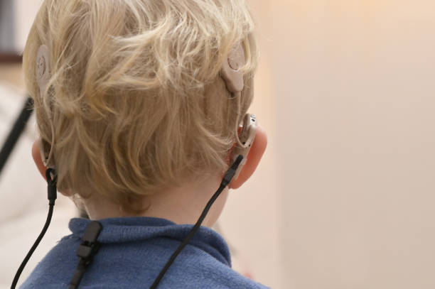 A Boy With A Hearing Aids And Cochlear Implants stock photo
