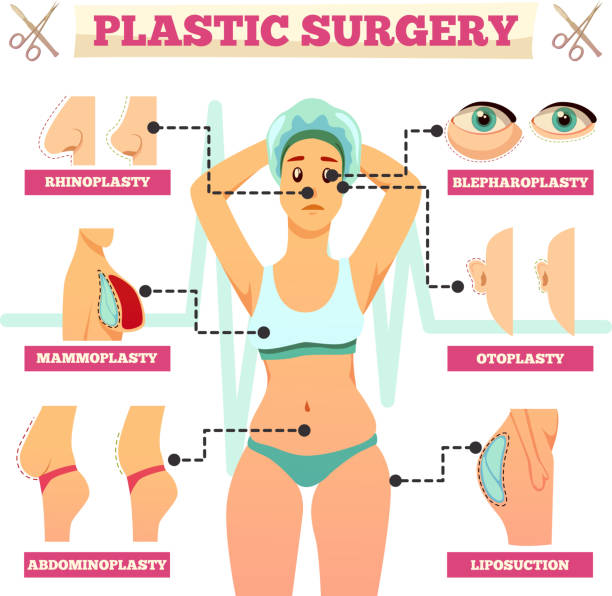 orthogonal flat plastic surgery flowchart Plastic surgery orthogonal flowchart with woman and types of operations for face and body flat vector illustration silicone implants stock illustrations