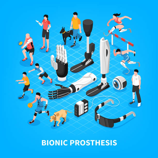 bioniczna proteza izometryczna - ludzki limb stock illustrations