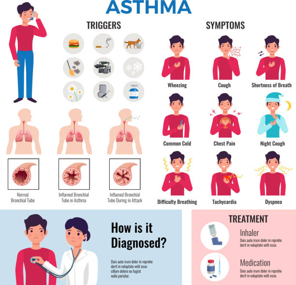 asthma set Asthma chronic disease flat infographic elements collection with triggers symptoms causes diagnosis medication and treatment vector illustration asma stock illustrations