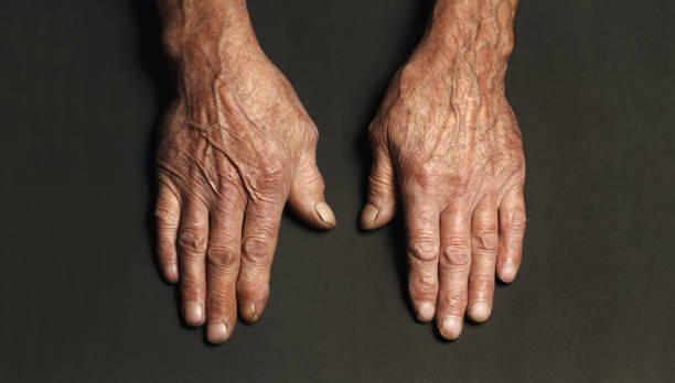 istock Wrinkled hands of an elderly man on a table close-up on a black 1201387589