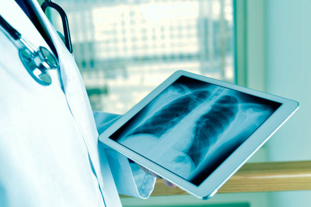médico observando uma radiografia torácica em um tablet - human lung x ray image x ray human spine - fotografias e filmes do acervo