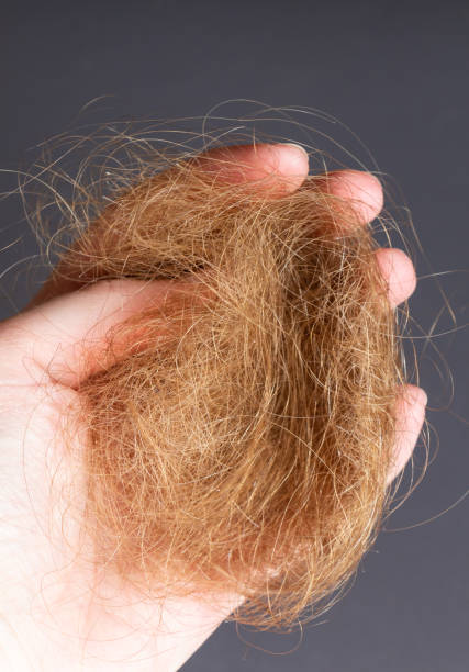istock Ball of hairs 1201455193