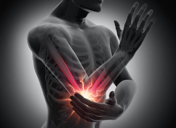 istock Elbow pain - conceptual artwork - 3d Illustration 1201462063