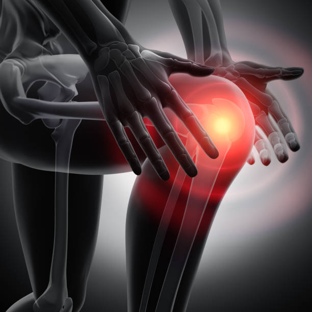 knee pain - conceptual artwork - 3d illustration - human joint human knee pain x ray imagens e fotografias de stock