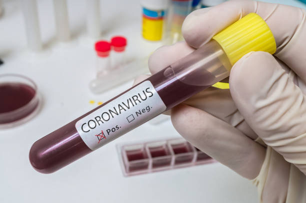 main retient le tube d'essai pour l'analyse de coronavirus 2019-ncov. - n& photos et images de collection