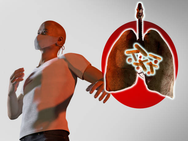 istock pneumonia China coronavirus concept, 3d render 1201515479