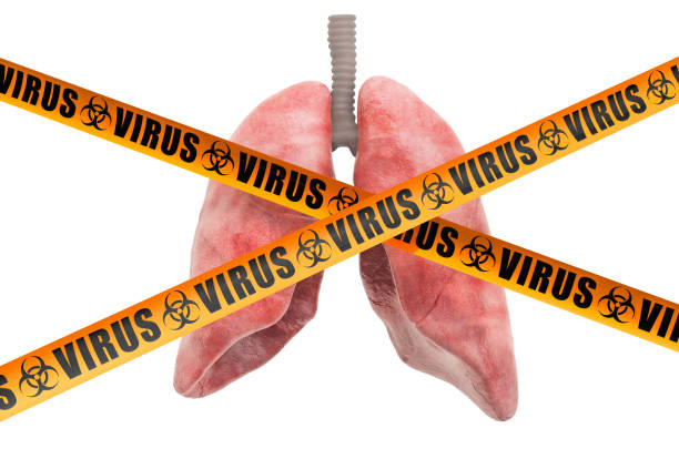 lungs viruses concept, 3d rendering isolated on white background - bronquiolite imagens e fotografias de stock