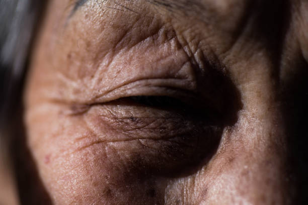 istock Close-up of a senior woman's eyes 1201569633