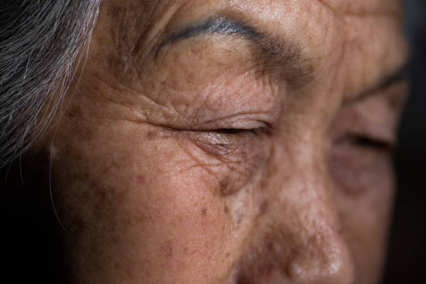 istock Close-up of a senior woman's eyes 1201569642